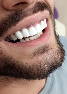 دندانپزشکی آپاتیت