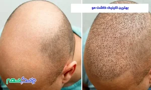 دکتر المیرا فرشین