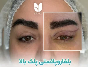 مرکز جراحی زیبایی تندیس شهریار