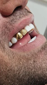 dental.sadaf🦷