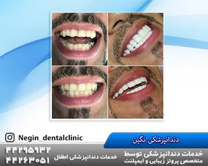 کلینیک دندانپزشکی نگین