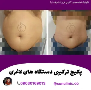کلینیک تخصصی لاغری فروغ شریف ارا 5