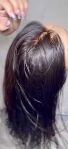 پروتز مو موکاران