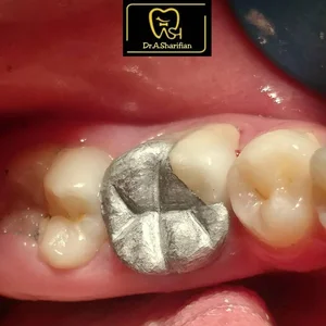 مطب دندانپزشکی دکتر علی اکبر شریفیان 4
