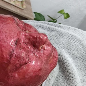 پاکسازی پوست نرگس شیرزاد 5