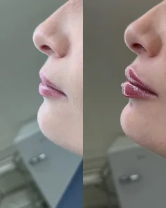 کلینیک لیزر نوران 2