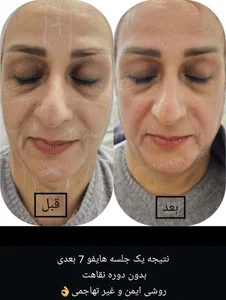کلینیک زیبایی سانی بیوتی 5