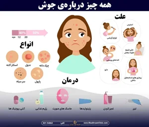 سریع ترین راه های از بین بردن جوش(لیزر یا درمان خانگی) - کلینیک ...