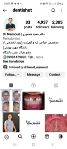 دکتر سلمان ابوالفضلی متخصص جراحی لثه وایمپلنت 3