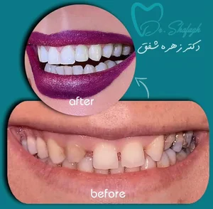 دندانپزشکی دکتر زهره شفق 3