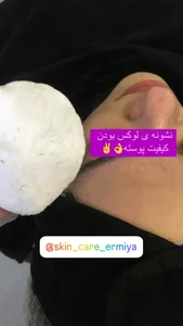 خدمات تخصصی پوست سارا زمانی 2