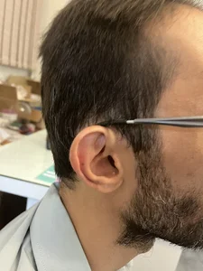 شنوایی سنجی و سمعک صفدری