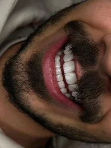 کلینیک دندانپزشکی دلین 4