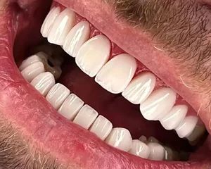 دندان پزشکی دکتر پارسا