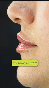 مرکز پزشکی پوست مو و زیبایی ممسنی(مریم هاشمی)