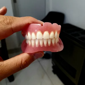 دندانسازی الماس 2