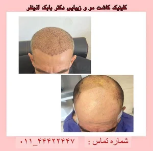مطب دکتر بابک آذین فر 3