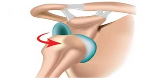 مرکز حرکات اصلاحی به توان