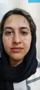 مطب دکتر ابراهیم فهیمی طب سوزنی 2