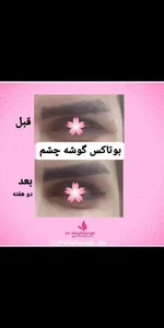 مطب دکتر شقایق قاضی پوست مو زیبایی لیزر بوتاکس لاغری 5