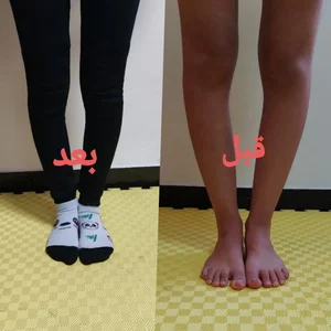 کلینیک ارتوپدی فنی پایش / اسکن پا / کفی طبی