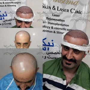 کلینیک کاشت مو وپوست و لیزر