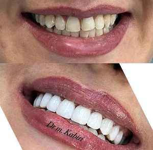 دندانپزشکی دکتر مهرناز کبیری