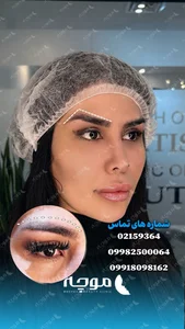 کلینیک زیبایی موچه 2