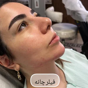 کلینیک زیبایی آنیل پلاس 4