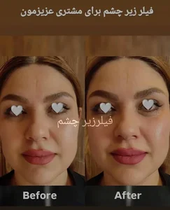 مرکز زیبایی الماس درخشان 5