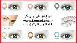 لنز طبی بایوفینیتی