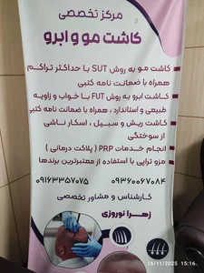 کلینیک تخصصی کاشت مو زهرا نوروزی 2