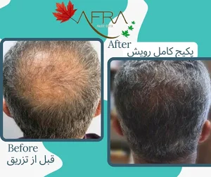 کلینیک جوانسازی و رویش مو افرا