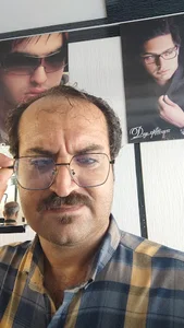 عینک چهره
