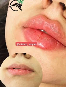 کلینیک زیبایی نویان