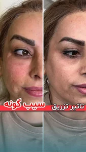 مرکز پوست،لیزر و زیبایی اوپال 2