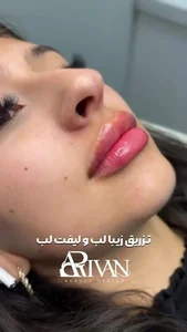 کلدکتر مهدی خسروی جراح عمومی در کلنیک اریوانینیک تخصصی پوست و مو آریوان 5