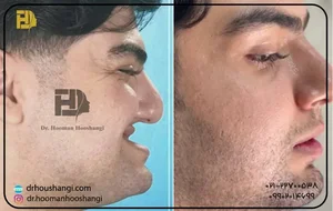 دکتر سید مهدی حسینی جراح فک صورت زیبایی Seyed Mehdi Hosseini