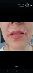طب سوزنی شهرزاد 5