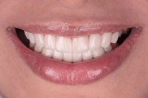 مرکز دندانپزشکی و زیبایی آرت - فرزانه مرتضوی فر