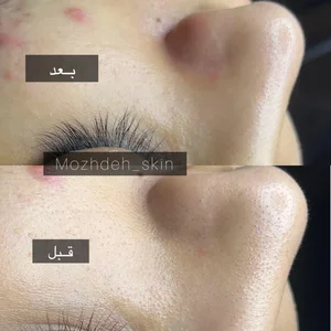 بیوتی تراپیست مژده حقیقت 4