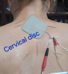 طب سوزنی شهرزاد 3