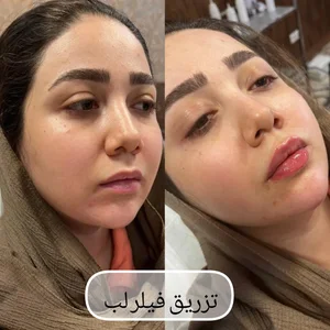 کلینیک زیبایی آنیل پلاس 5