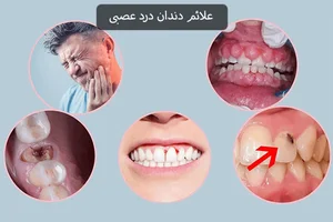 دندان درد عصبی چیست؟ علل، علائم و راه‌های درمان آن