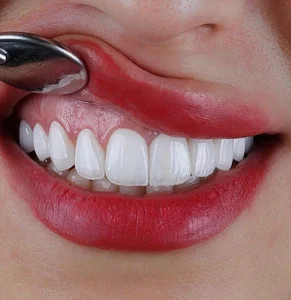دندانپزشکی نفس دنتال