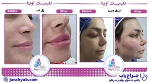 کلینیک پوست و مو آوینا کرج
