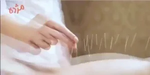 پزشک متخصص طب سوزنی 2
