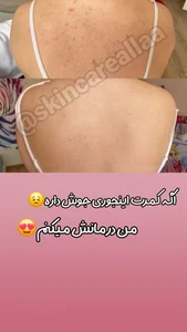 کلینیک پاکسازی وفیشیال پوست آلا بانو 3