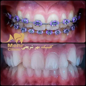 کلینیک دندانپزشکی مهر شریعتی 3