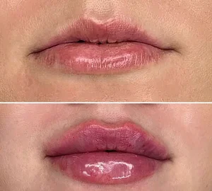 کلینیک پوست و مو زیبایی ژل ،بوتاکس ،فیلر،هایفو،آراف ولیزر دکتر ستارپور